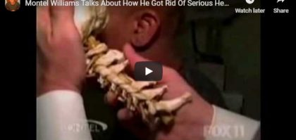 A video thumbnail of doctor ellaborating neck pain problem with neck bone model